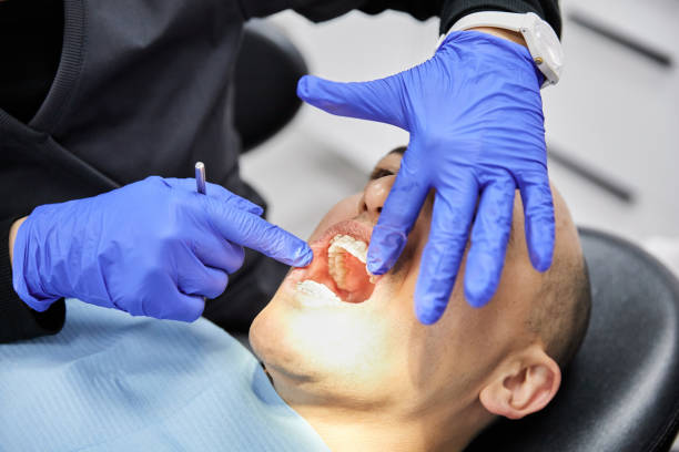 Best Emergency Wisdom Tooth Extraction in Twin Lakes, CA